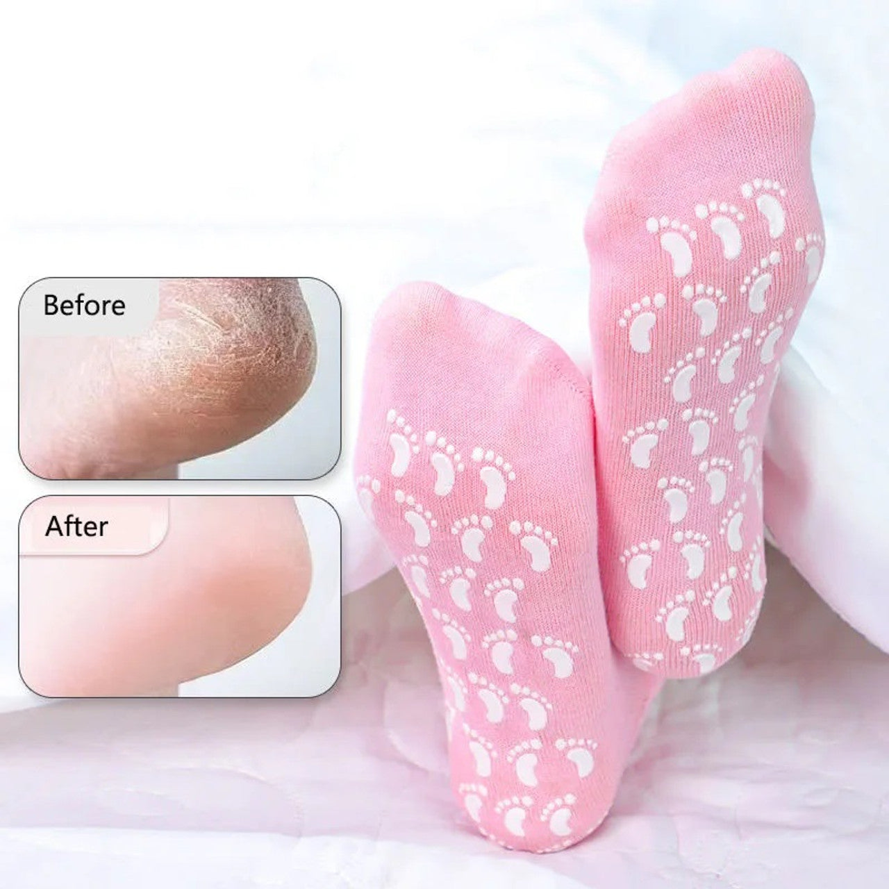 Pair of Reusable SPA Silicone Gel Socks