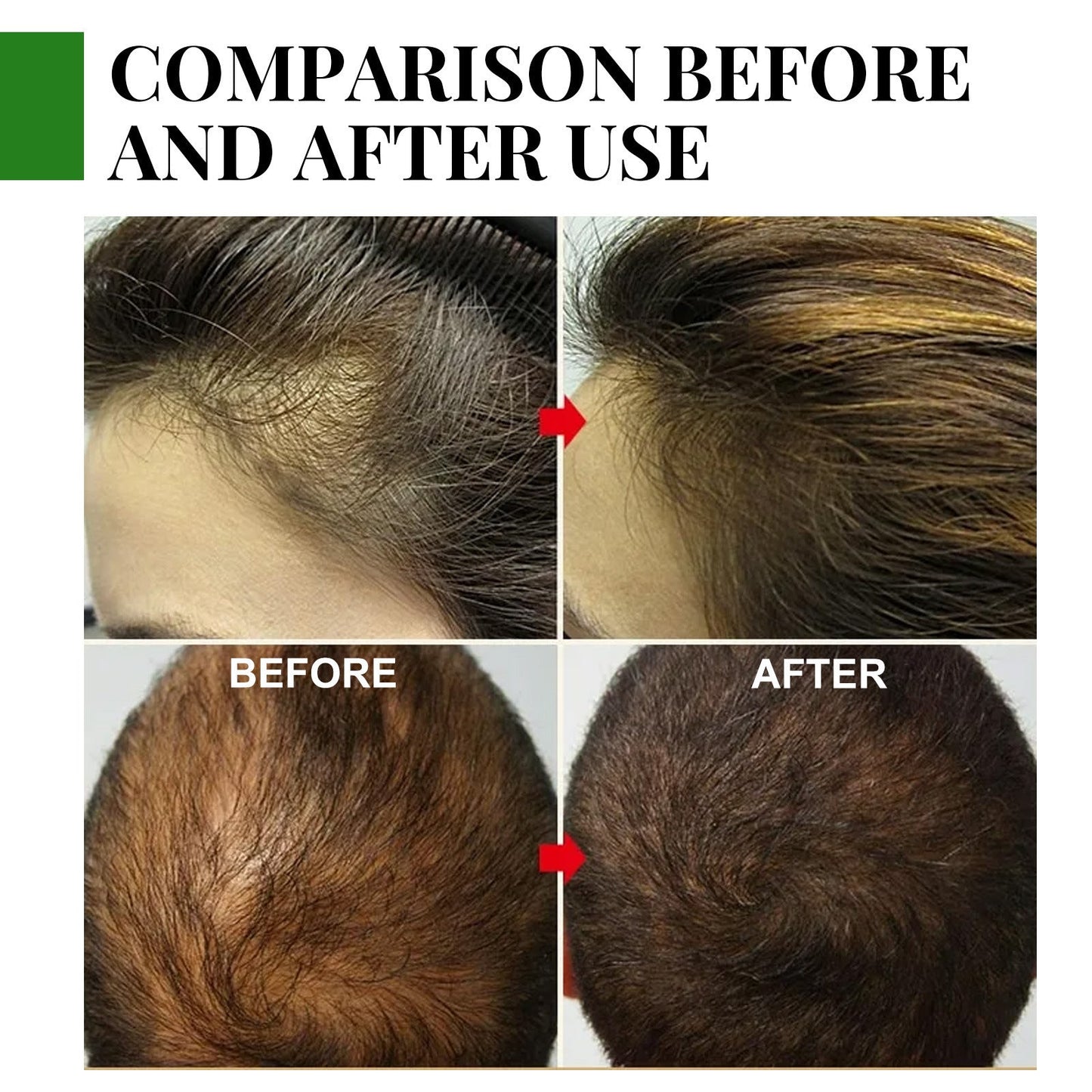 Care Essential Oil Anti-loss Hair Growth Hair Care Nourish Scalp Hair Roots