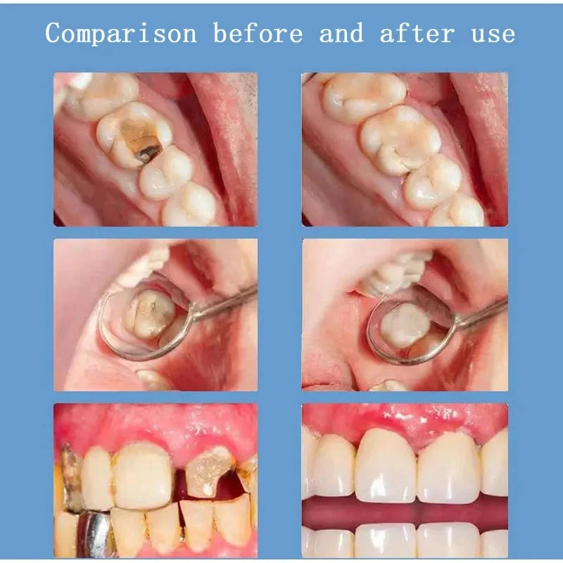 Sp4 Ultra White Teeth Toothpaste