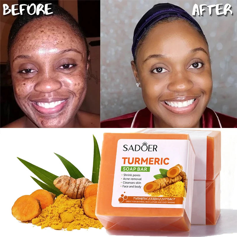 Turmeric Kojic Acid Soap Whitening & Brightening ( BUY 1 GET 1 FREE )