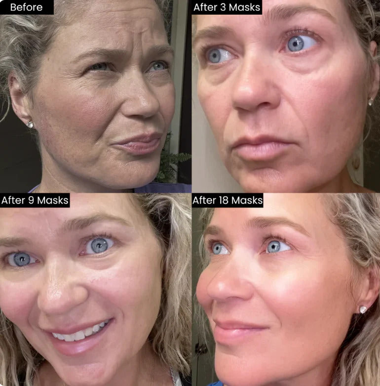 Deep Collagen Multi Lift-Up Mask ( 5 Masks In BOX )