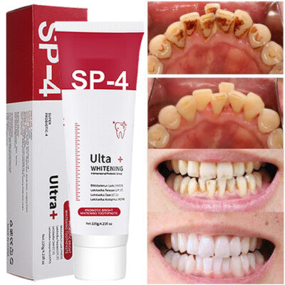 Sp4 Ultra White Teeth Toothpaste